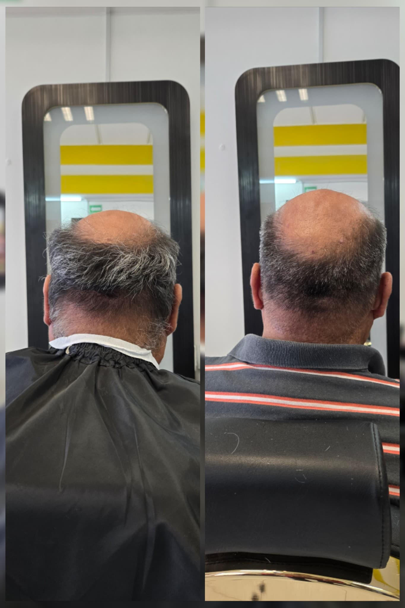 Corte hombre
